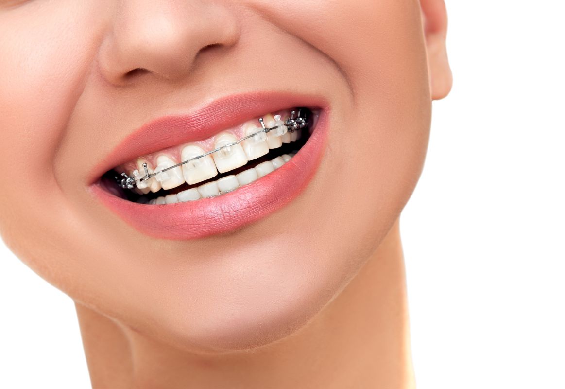 Specjalista od wad zgryzu – ortodonta